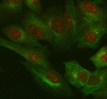 Immunofluorescent staining of FFPE human A549 cells with IL-18 antibody (red) and Beta Tubulin mAb (green). HIER: steam section in pH6 citrate buffer for 20 min.