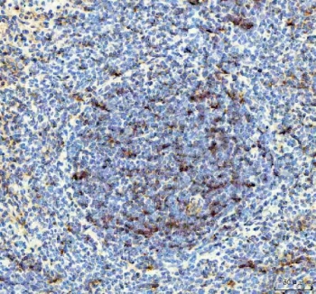 IHC staining of FFPE rat spleen tissue with IL-18 antibody. HIER: boil tissue sections in pH8 EDTA for 20 min and allow to cool before testing.