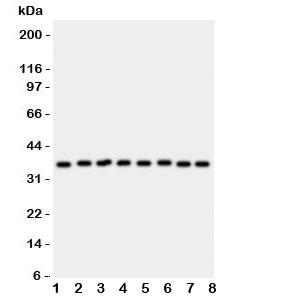 Western blot testing of Annexin V antibody and rat samples 1: lung;  2: brain;  3: heart;  4: kidney; and human samples  5: HeLa;  6: SMMC-7721;  7: A549;  8: SGC lysate. Predicted molecular weight ~36 kDa.