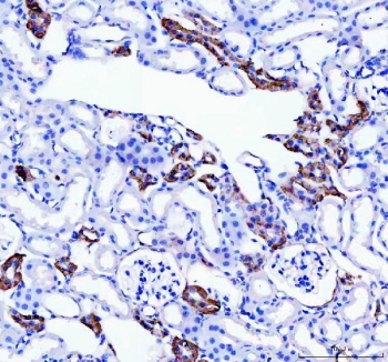 Western blot testing of Calbindin antibody (0.5ug/ml) and rat lysate samples 1) brain, 2) kidney.  Expected molecular weight: 27-28 kDa, observed here at ~37 kDa.