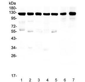 Western blot testing of human 1) HeLa, 2) U-87 MG, 3) T-47D, 4) A549, 5) U-2 OS, 6) rat brain and 7) mouse brain lysate with Amyloid beta antibody. Predicted molecular weight 79~120 kDa depending on glycosylation level.