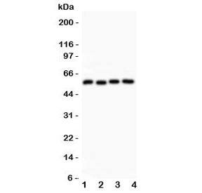Western blot testing of Cyclin B1 antibody and Lane 1:  HeLa;  2: 293T;  3: MCF-7;  4: COLO320 lysate. Predicted molecular weight: 48-60 kDa.