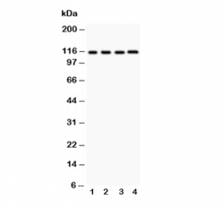 Western blot testing of NALP3 antibody and lysates from the human tumor cell lines 1:  HeLa;  2: MCF-7;  3: Jurkat;  4: HEPG2. Predicted molecular weight ~118 kDa.