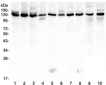Western blot testing of human 1) K562, 2) HeLa, 3) 293T, 4) A431, 5) Caco-2, 6) PC-3, 7) MCF7, 8) U-2 OS, 9) rat testis and 10) mouse testis lysate with Bub1 antibody at 0.5ug/ml. Predicted molecular weight ~122 kDa.