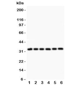 Western blot testing of MyD88 antibody and Lane 1:  rat heart;  2: human HeLa;  3: (h) MCF7;  4: (h) HEPG2;  5: (h) Jurkat;  6: (h) Raji lysates. Predicted molecular weight: 33 kDa