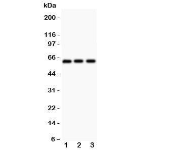 Western blot testing of Perforin antibody and Lane 1:  HeLa;  2: COLO320;  3: HEPG2.  Predicted/observed size ~61KD