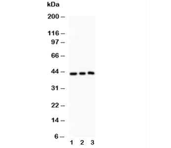 Western blot testing of SIRT2 antibody and Lane 1:  rat spleen;  2: HeLa;  3: A549