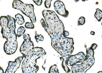 IHC staining of FFPE human placental tissue with BRAF antibody. HIER: boil tissue sections in pH8 EDTA for 20 min and allow to cool before testing.