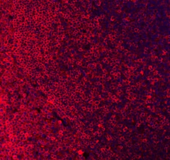 Immunofluorescent staining of FFPE human tonsil tissue with CD79a antibody (red) and DAPI nuclear stain (blue). HIER: boil tissue sections in pH8 EDTA for 20 min and allow to cool before testing.