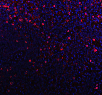 Immunofluorescent staining of FFPE human tonsil tissue with CD79b antibody (red) and DAPI nuclear stain (blue). HIER: steam section in pH8 EDTA buffer for 20 min.