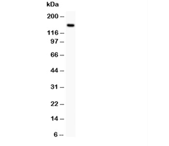 Western blot testing of c-Met antibody and rat liver lysate. Predicted molecular weight ~156 kDa.