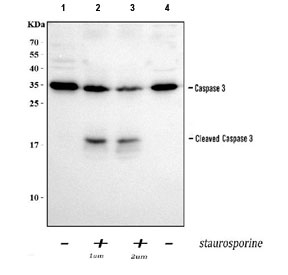 Western blot testing of Caspase-3 antibody and Lane 1:  rat liver;  2: rat thymus;  3: SMMC-7721 lysate. Predicted molecular weight ~32 kDa.