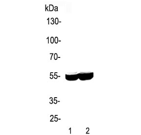 Western blot testing of 1) rat liver and 2) mouse liver lysate with CYP2E1 antibody. Predicted molecular weight ~57 kDa.