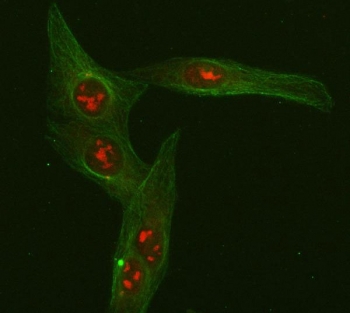 Immunofluorescent staining of FFPE human U-2 OS cells with FOXO3A antibody (red) and Beta Tubulin mAb (green). HIER: steam section in pH6 citrate buffer for 20 min.