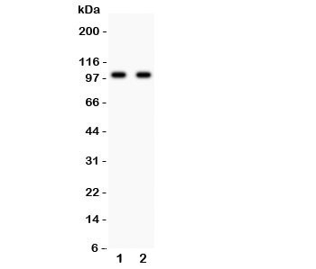 Western blot testing of GLUR4 antibody and Lane 1:  rat brain;  2: mouse brain lysate.  Predicted/observed molecular weight: ~101 kDa.