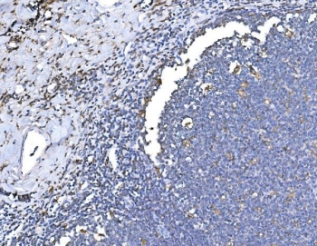 IHC staining of FFPE human tonsil tissue with HO-1 antibody. HIER: boil tissue sections in pH8 EDTA for 20 min and allow to cool before testing.