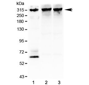 Western blot testing of 1) human SHG-44 (glioma), 2) rat brain and 3) mouse brain lysate with IP3R antibody at 1ug/ml. Predicted molecular weight ~314 kDa.