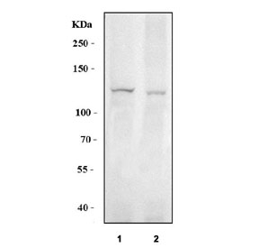 Western blot testing of human 1) PC-3 and 2) U-87 MG cell lysate with BK channel antibody. Predicted molecular weight: 130-140 kDa (multiple isoforms).