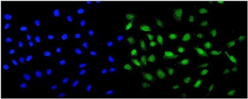 Immunofluorescent staining of FFPE human U-2 OS cells with MCAK antibody (green) and DAPI nuclear stain (blue). HIER: steam section in pH6 citrate buffer for 20 min.