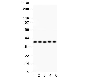 Western blot testing of KLF6 antibody and Lane 1:  human placenta;  2: rat testis;  3: (h) HeLa;  4: (h) HEPG2;  5: mouse HEPA lysate.  Expected size: 32~40KD