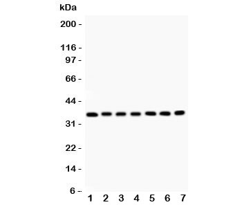 Western blot testing of RACK1 antibody and Lane 1:  mouse liver;  2: rat spleen;  3: (m) spleen;  4: human SMMC-7721;  5: (h) HEPG2;  6: (m) HEPA;  7: (r) RH35 lysate.  Predicted molecular weight: ~35 kDa.