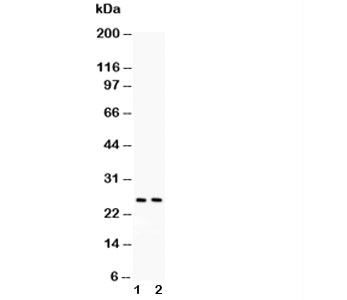 Western blot testing of TNF-a antibody in mouse kidney (1) and intestine (2) lysate