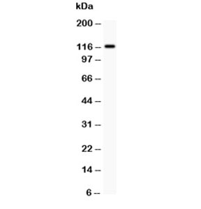 Western blot testing of c-Kit antibody and HEPG2 lysate. Observed molecular weight: ~120/145kDa (precusor/mature).