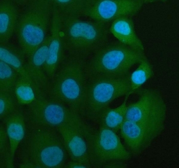 Immunofluorescent staining of FFPE human HeLa cells with MIF antibody (green) and DAPI nuclear stain (blue). HIER: steam section in pH6 citrate buffer for 20 min.