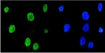 Immunofluorescent staining of FFPE human A431 cells with Mad2L1 antibody (green) and DAPI nuclear stain (blue). HIER: steam section in pH6 citrate buffer for 20 min.