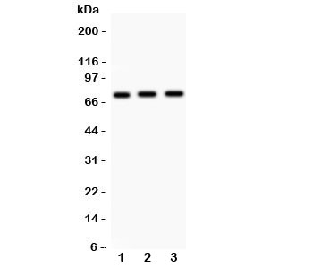 Western blot testing of Myb antibody and human samples 1:  placenta;  2: SMMC-7721;  3: HeLa lysate.   Expected/observed molecular weight ~72kDa.