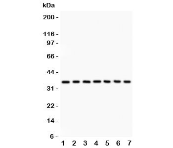 Western blot testing of IkBa antibody and Lane 1:  rat brain;  2: mouse brain;  3: (r) kidney;  4: (m) kidney;  5: human 293T;  6: (h) Jurkat;  7: (h) Raji lysate.  Expected/observed size ~36KD