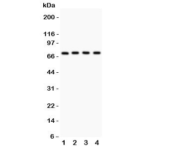 Western blot testing of Neuregulin-1 antibody and Lane 1:  MCF-7;  2: SKOV;  3: 22RV1;  4: COLO320 lysate.  Predicted/observed size ~70KD