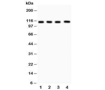 Western blot testing of Neuropilin 1 antibody and Lane 1:  (h) U87;  2: (h) A549;  3: human placenta;  4: rat heart lysate.  Predicted size: 102~130KD