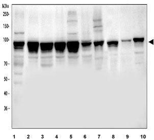 Western blot testing of 1) human HeLa, 2) human K562, 3) human MCF7, 4) human COLO-320, 5) human HepG2, 6) human HaCaT, 7) monkey COS-7, 8) rat NRK, 9) mouse lung and 10) mouse NIH 3T3 cell lysate with NUP98.  Predicted molecular weight ~98 kDa.