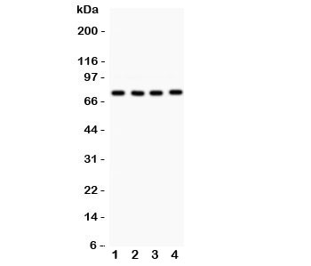 Western blot testing of PKC alpha antibody and Lane 1:  rat brain;  2: mouse brain;  3: (m) heart;  4: human 22RV1.  Predicted molecular weight: ~77 kDa.
