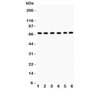 Western blot testing of PKC iota antibody and Lane 1:  SHG-44;  2: A549;  3: U87;  4: 293T;  5: HeLa;  6: Jurkat.  Predicted/expected size ~68KD