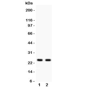 Western blot testing of Rab3A antibody and Lane 1:  rat brain;  2: mouse brain lysate