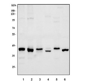 Western blot testing of 1) human HeLa, 2) human K562, 3) human Jurkat, 4) rat liver, 5) rat C6 and 6) mouse liver tissue lysate with RAD51 antibody.  Expected molecular weight ~37 kDa.