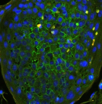 Immunofluorescent staining of FFPE human tonsil with CD44 antibody (green) at 1ug/ml and DAPI nuclear stain (blue). HIER: steam section in pH6 citrate buffer for 20 min.