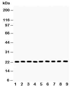 Western blot testing of PRDX1 antibody and Lane 1:  rat brain;  2: mouse brain;  3: human U87;  4: (m) Neuro-2a;  5: (h) A375;  6: (h) 293T;  7: (h) SMMC;  8: (h) A549;  9: (h) RH35 lysate.  Expected molecular weight: ~22 kDa.