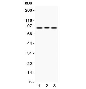 Western blot testing of SEMA3A antibody and Lane 1:  293T;  2: A549;  3: HeLa lysate.  Predicted molecular weight: ~89 kDa.