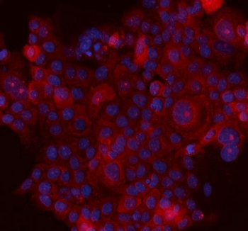 Immunofluorescent staining of FFPE human A431 cells with SERPINB5 antibody (red) and DAPI nuclear stain (blue). HIER: steam section in pH6 citrate buffer for 20 min.