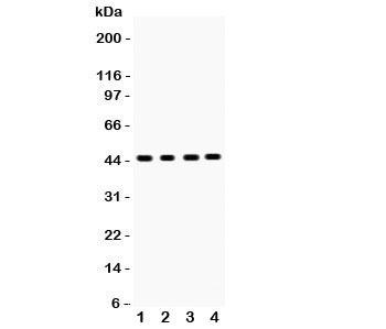 Western blot testing of SERPINB5 antibody and Lane 1:  mouse intestine;  2: human placenta;  3: (h) MCF-7;  4: (h) MM231 lysate.  Predicted molecular weight: 42~45 kDa.