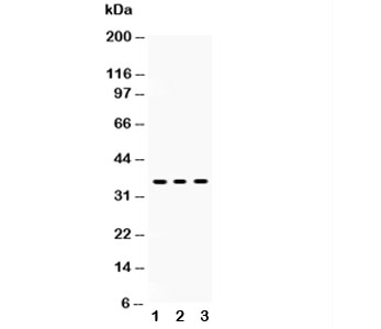 Western blot testing of SIRT6 antibody and Lane 1:  HeLa;  2: A549;  3: human placenta lysate