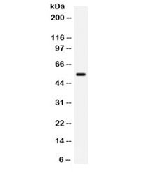 Western blot testing of human placenta lysate with BMPR1B lysate. Predicted/observed molecular weight: 55-60 kDa.