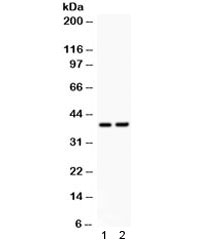 Western blot testing of 1) rat brain and 2 mouse NIH3T3 lysate with SOX1 antibody.  Predicted/observed molecular weight ~39 kDa.