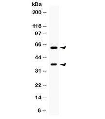 Western blot testing of human HeLa cell lysate with TPP1 antibody. Expected molecular weight: 61/34 kDa (isoforms 1/2).