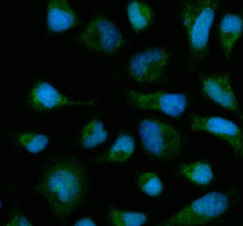 Immunofluorescent staining of FFPE human HeLa cells with SLC22A2 antibody (green) and DAPI nuclear stain (blue). HIER: steam section in pH6 citrate buffer for 20 min.