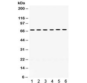 Western blot testing of 1) rat liver, 2) rat lung, 3) mouse liver, 4) mouse lung, 5) human COLO320 and 6) human MCF7 lysate with PDPK1 antibody. Expected molecular weight ~63 kDa, observed here at ~70 kDa.