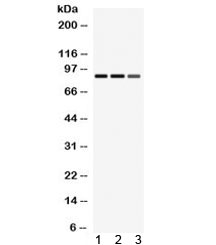 Western blot testing of 1) rat spleen, 2) rat lung, 3) mouse HEPA lysate with MEFV antibody. Expected/observed molecular weight ~86 kDa.